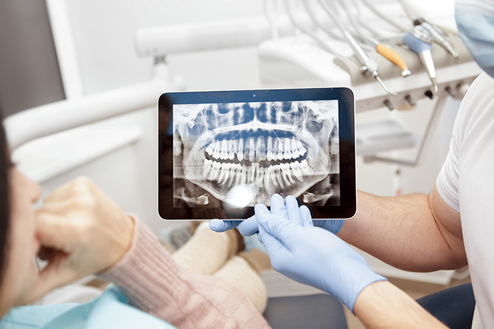 Dental Technology - Digital X-Rays